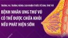 Tháng nâng cao nhận thức về ung thư vú: Bệnh nhân ung thư vú có thể được chữa khỏi nếu phát hiện sớm