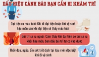 Bác sĩ cảnh báo những dấu hiệu cần đi khám trĩ ngay