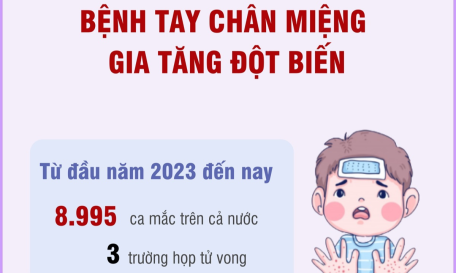 Cảnh báo bệnh tay chân miệng gia tăng đột biến