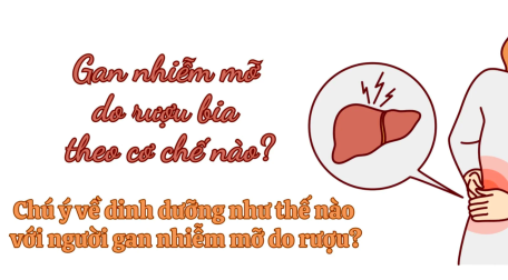 Gan nhiễm mỡ do rượu bia theo cơ chế nào?